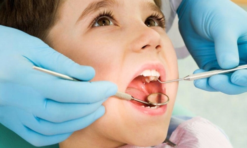 ¿Cuándo llevar un niño pequeño al dentista?